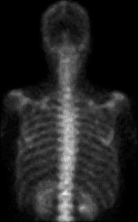 (α) (β) (γ) (δ) (α) Εικόνα µε θόρυβο poisson.