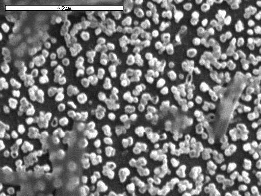 5 μm (A) 5 μm (B) Σχήμα 29: Μικρογραφίες SEM αποθέματος Au (σε προαποτεθέντα Cu (693 μονοστιβάδες)) σε υπόστρωμα υαλώδους άνθρακα (βύθιση σε διάλυμα 0.