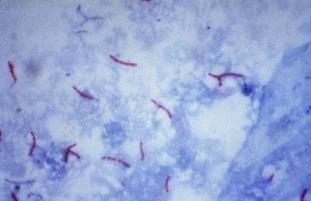 Κλασσική Διάγνωση Χρονοβόρα Παράδειγμα - Μυκοβακτηρίδια Μεγάλη επώαση καλλιεργειών (3-4 εβδομάδες) Φαινοτυπική ποικιλομορφία Δύσκολη απομόνωση