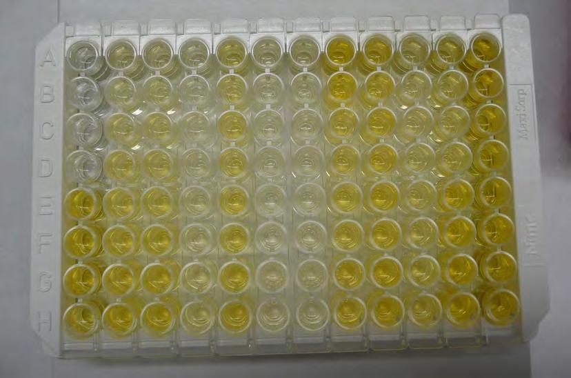 2) 25μL 25μL ΑTCI συγκέντρωσης 15mM 3) 75μL DTNB συγκέντρωσης 3Mm και 4) 25μL δείγματος από τα SS ή DS κλάσματα των υπό μελέτη εγκεφαλικών περιοχών.