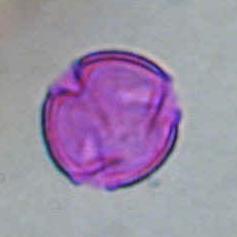 ACTINIDACEAE Actinidia chinensis ΠΕΡΙΟΔΟΣ