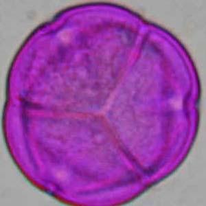 27.2 μm (26.3-30.