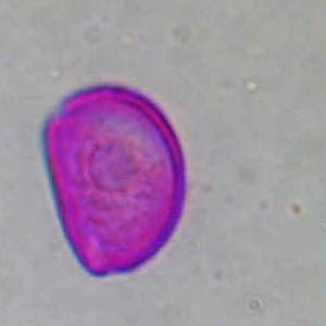 LILIACEAE Allium cepa ΠΕΡΙΟΔΟΣ ΑΝΘΟΦΟΡΙΑΣ: Ιούνιος