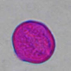 LEGUMINOSAE Trifolium nigrescens ΠΕΡΙΟΔΟΣ