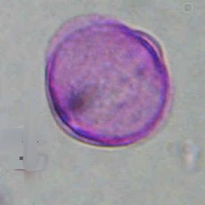 Γύρη 2 μm (28.4-33.5) ΔΙΑΜΕΤΡΟΣ Ε: 28.2 μm (27.