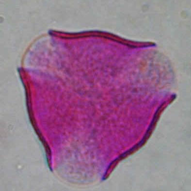 Prunus persica ROSACEAE ΠΕΡΙΟΔΟΣ ΑΝΘΟΦΟΡΙΑΣ: