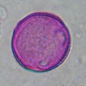 VΙΤACEAE Parthenocissus inserta ΠΕΡΙΟΔΟΣ