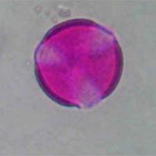 1) ΣΧΗΜΑ: ωοειδές Vitex-agnus castus ΠΕΡΙΟΔΟΣ
