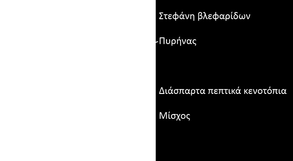 Sessilida Οικογένεια: Vorticellidae Γένος:
