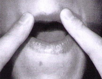 Άσκηση 4: Κρύψιμο δοντιών με τα χείλη (Εικόνα 4.14.) Οδηγίες άσκησης: Με ανοιχτό το στόμα, τα χείλη πρέπει να περιβάλλουν τα άνω και κάτω δόντια.