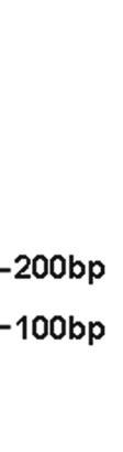 Ανίχνευση η της NP PM/ALK, t(2;5)(p23;;q35) στηνν περίίπτωση τηςς