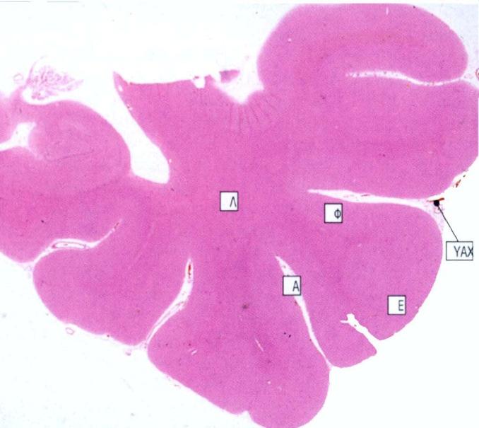 Εγκεφαλικός φλοιός Λ Φ Λ Φ