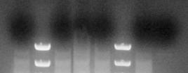 69 Εικόνα 2.3: Ανάλυση PCR για την επιλογή κλώνων knock out του στελέχους E.