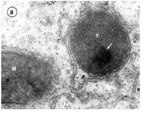 1 to 1 μm in diameter) Μονή λιπιδική διπλοστοιβάδα (μεμβράνη) 60 80 Å