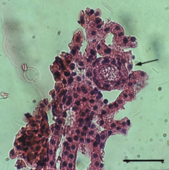Εικόνα 17. Ωοκύτταρο στο βλαστικό στρώµα. Κλίµακα = 0,05 mm.