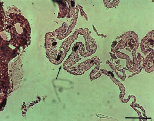 Cross section of ovary in February showing early vitellogenic (Ω2), previtellogenic (Ω1) and post-vitellogenic (Ω4) ovarian follicles. Bar =.125 mm.