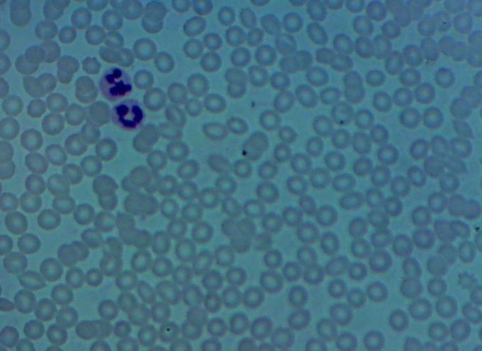 Κύτταρα του αίματος μας μεγαλωμένα κατά 400 φορές στο οπτικό μικροσκόπιο: είναι όλα ερυθροκύτταρα εκτός από τα 2 λευκοκύτταρα που δείχνει το βέλος Παρατηρείστε ότι στα ερυθροκύτταρα δεν υπάρχει