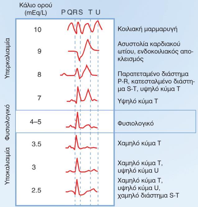 Μηχανισμός