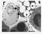 Βρέθηκε ότι οι IgG έναντι-pr3 (proteinase 3) διεισδύουν στα ΡΜΝ και εντοπίζονται στα κοκκία και στις περιοχές όπου οι διεργασίες καταστροφής (εκτεταμένα αποπτωτικά γεγονότα) των ΡΜΝ λαμβάνουν χώρα.