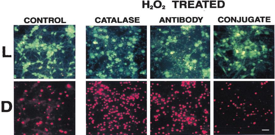1 2 3 4 Εικόνα 22: Το σύμπλοκο mab 3E10-καταλάση προστατεύει τους πρωτοταγείς νευρώνες του φλοιού από τις επαγόμενες με υπεροξείδιο (Η 2 Ο 2 ) βλάβες.