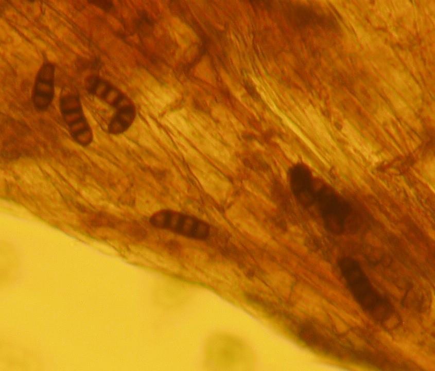Παρασκεύασμα με σπόρια Thielaviopsis basicola