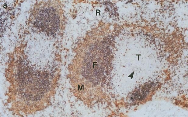 Δευτερογενή λεμφικά όργανα: Σπλήνας B-cell follicles Periarteriolar lymphoid sheath R: red pulp F: follicle T: T cell zone M: marginal zone central