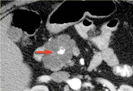 CT ή MRI?