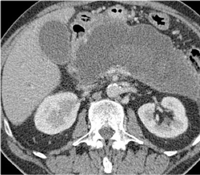 CT ή MRI?