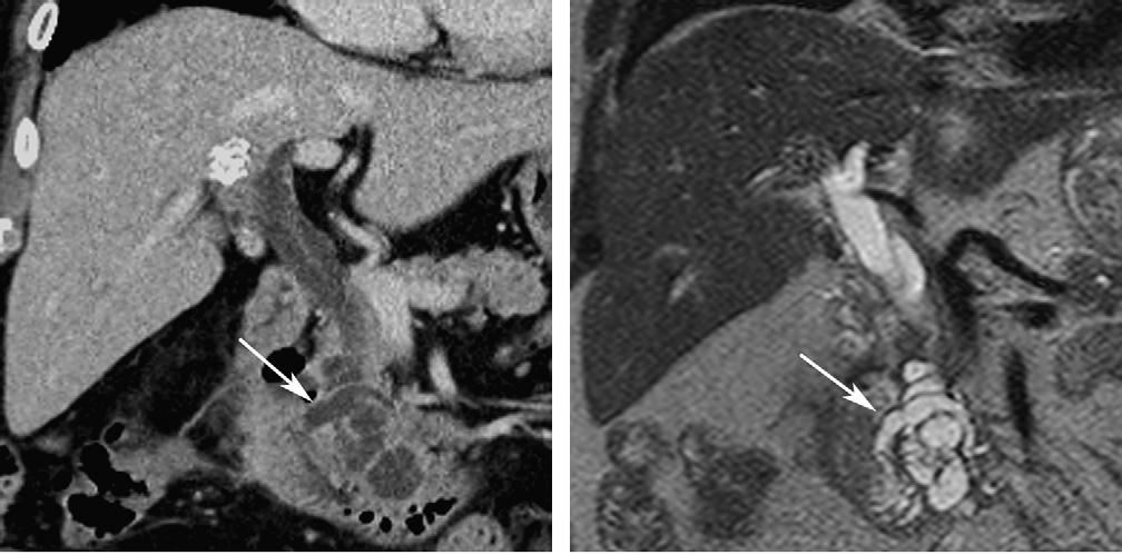 CT ή MRI?