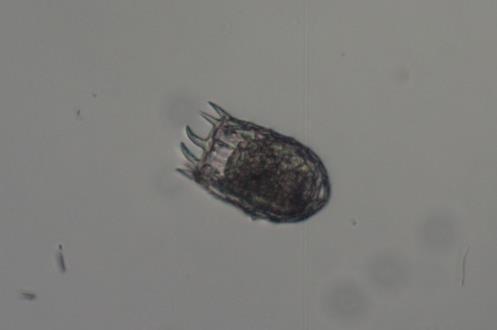 100μm 1 2 1)