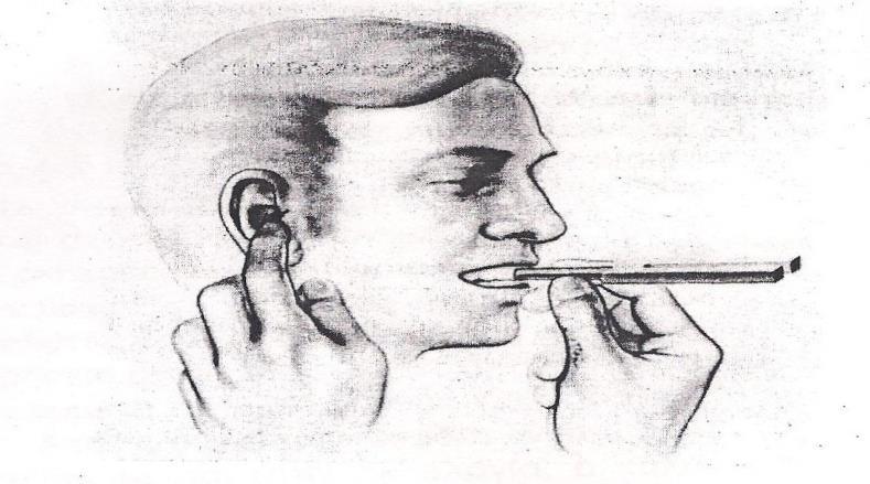 Η διάγνωση της βαρηκοΐας αποτέλεσμα αύξηση της ακουστικότητας του ήχου δια της οστέινης αγωγής του αποφραγμένου αυτιού.