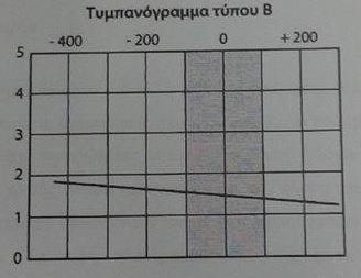 Η διάγνωση της βαρηκοΐας προσδιορισμός του σημείου της μέγιστης ενδοτικότητας.