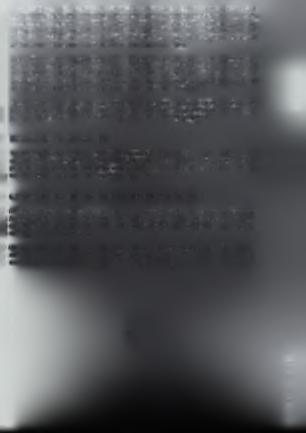 ν ωυκ,-ιιρ), η ανάρρωση κ α ι η ια τρ ική επιρκεψη, η αναπαυοη, η αισυητικη η πλαστική χειρουργική (εκτός αν είναι συνέπεια ατυχήματος που έγινε κατά τον χρόνο ισχύος του παραρτήματος αυτού), ο ι εκ