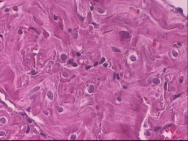 ΕΙΚΟΝΑ 13: Μυοκάρδιο πειραµατοζώων στα οποία χορηγήθηκε ροφεκοξίµπη για διάστηµα 20 ηµερών. Οι ίνες του µυοκαρδίου φαίνονται ίδιες µε του µάρτυρα.