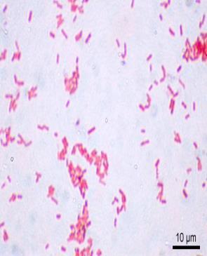 Γαστρεντερίτιδες από Escerichia coli 2/3 Δοσολογία λοίμωξης >10 8 /γρ Χρόνος επώασης: 8-24 ώρες Συμπτώματα: πυρετός, ρίγος, μυϊκοί πόνοι, κοιλιακοί σπασμοί, διάρροια (EEC) ΕΤΕC: