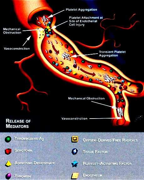Madjid M et al, Cardiovascular