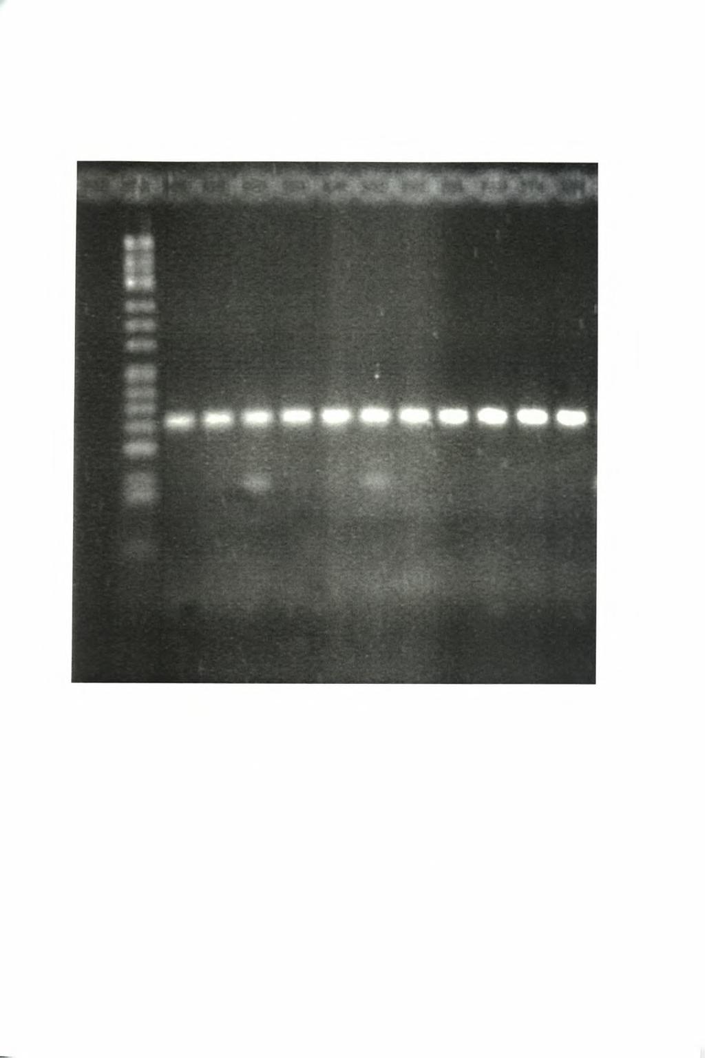Εικόνα 2: PCR προϊόν του
