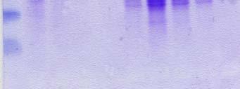 (4,5), 100 (6,7), 150mM ιµιδαζολίου (8,9,10).