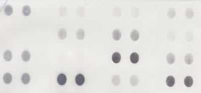 Αποτελέσµατα P 7 15 23 N 8 16 24 1 9 17 25 2 10 18 26 3 11 19 27 4 12 20 5 13 21 6 14 22 Εικόνα 67: Έλεγχος της έκλουσης των α4-flag και β2-6xhis από τη στήλη ακινητοποιηµένου νικελίου µε