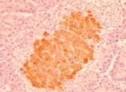 Regeneration (neonatal rat model) Insulin Vildagliptin 60