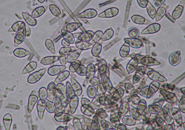 Κονίδια Pyricularia grisea Πηγή: Paul Bachi, University
