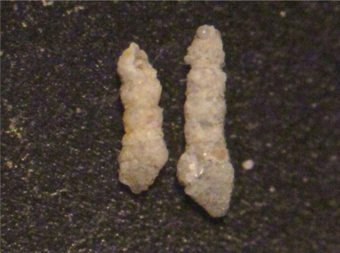 Εικόνα 13: Bigenerina sp. Υπεροικογένεια: Eggerelloides Οικογένεια: Eggerellidae Γένος: Karreriella CUSHMAN Περιγραφή: Το κέλυφος είναι επίμηκες, κωνικό και τροχοσπειροειδές.
