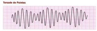 πολύμορφης κοιλιακής ταχυκαρδίας (torsades de pointes) και αιφνίδιου καρδιακού θανάτου Ο
