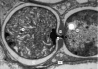 heterocysts In some diazotrophs, the FeSII protein protects nitrogenase transiently and reversibly when oxygen levels are high Behavioural: Avoid oxygen (anaerobic