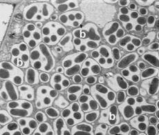 Diazotrophs that fix nitroge