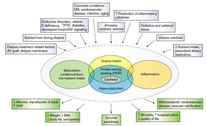 Πρωτεϊνοθερμιδικός υποσιτισμός Fouque D. et al.