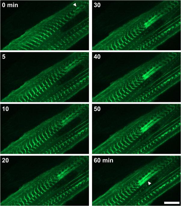 Απεικόνιση, με μέθοδο φθορισμού, ανάπτυξης in vitro κάκωσης στα μυϊκά κύτταρα C2C12 που εκφράζουν το γονίδιο FLNc- EGFP, ως δείκτη κάκωσης Lesion formation seen by live cell imaging of C2C12
