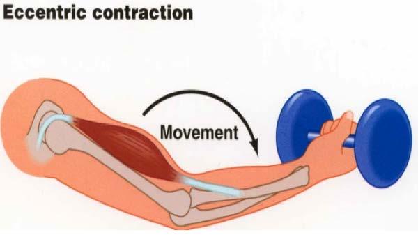 Έκκεντρη Μυϊκή Συστολή Eccentric Muscle Contraction Η συστολή κατά την οποία ο μυς