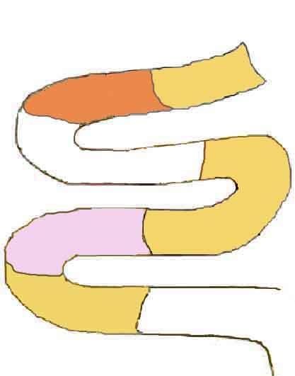 74 / 57