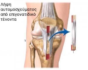 http://orthopaidikos4u.
